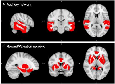 Resting-State Connectivity of Auditory and Reward Systems in Alzheimer’s Disease and Mild Cognitive Impairment